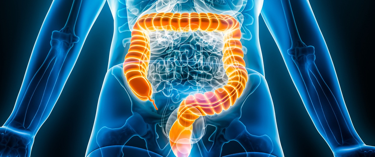 Latest Insights Into the Causes of Inflammatory Bowel Disease